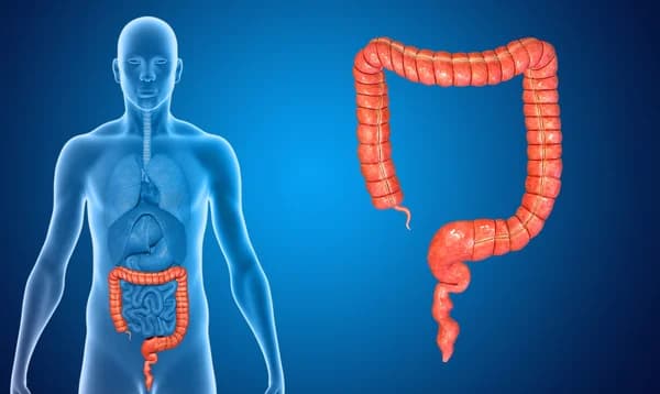 Ilustración médica detallada del intestino grueso e hidroterapia de colon en Rena.Ser